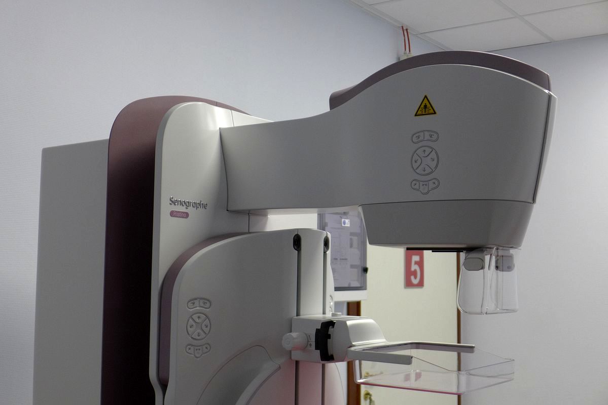 Szpitalny mammograf – ruszyły badania